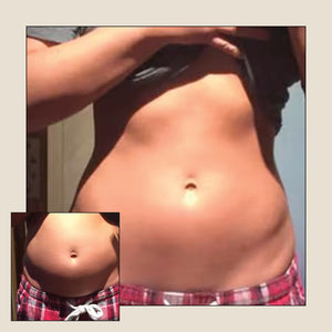 ערכת Lipo For Me